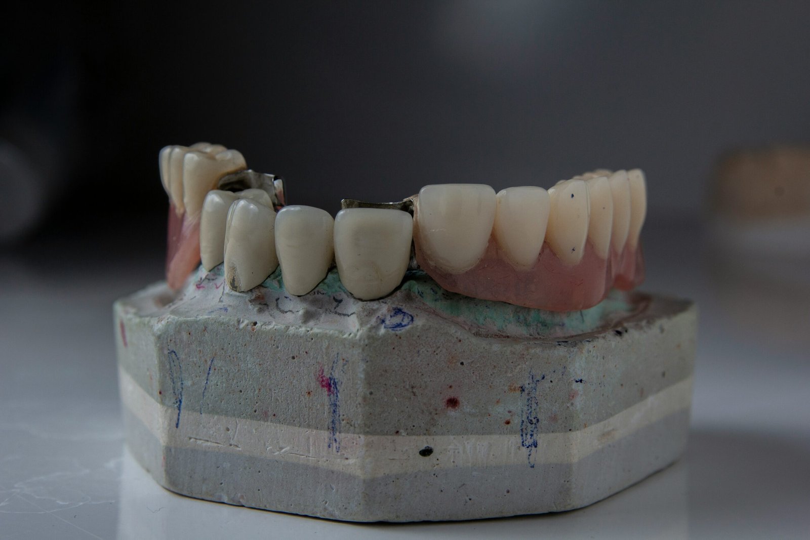 Root Canal Treatment-03