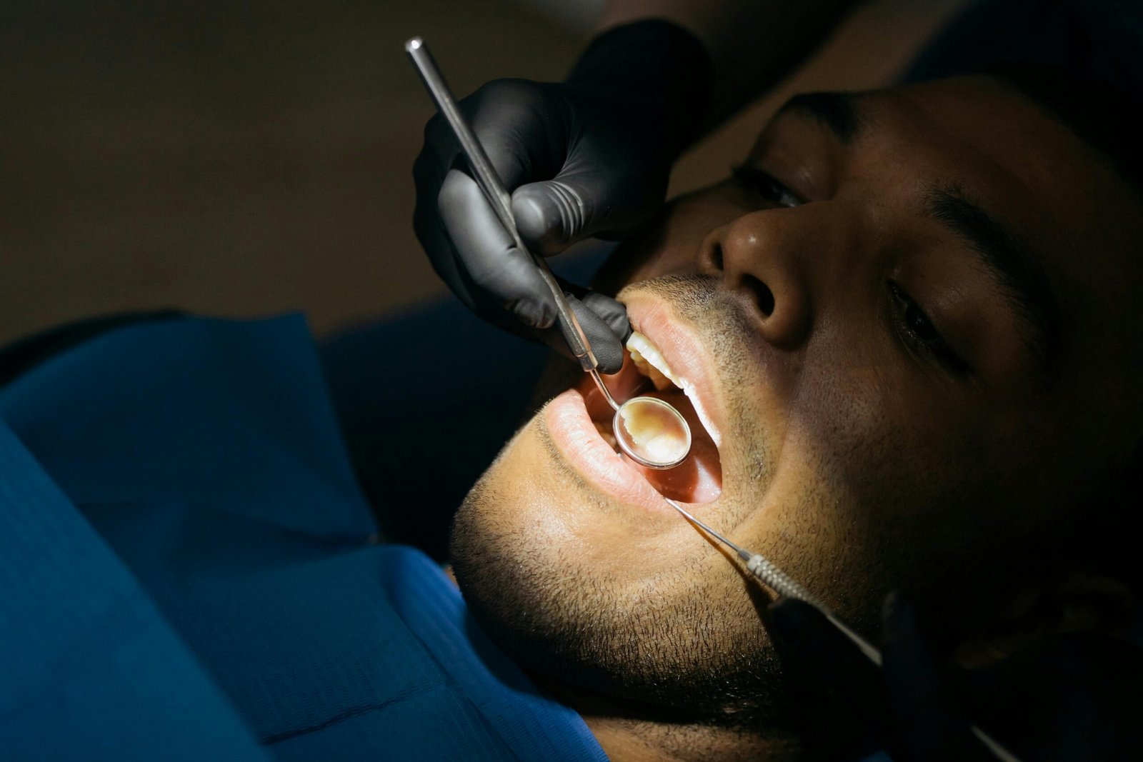 Tooth Polishing